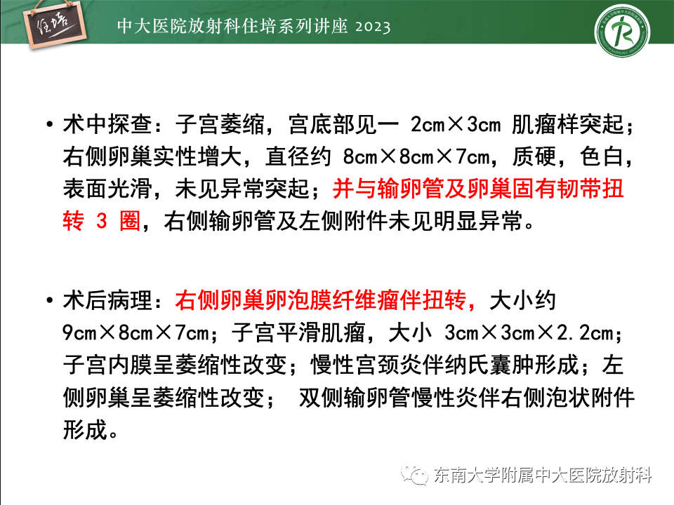 影像PPT - 【PPT】卵巢扭转诊断与鉴别诊断-21