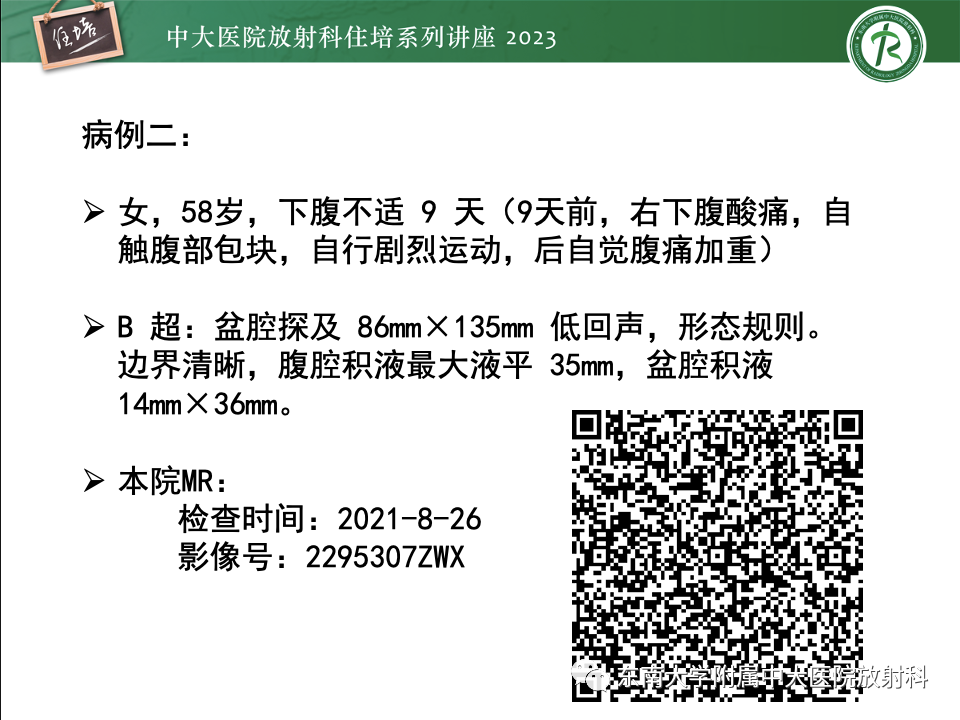 影像PPT - 【PPT】卵巢扭转诊断与鉴别诊断-22