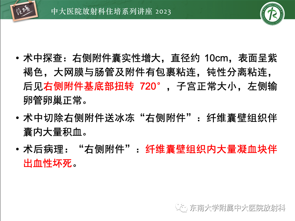 影像PPT - 【PPT】卵巢扭转诊断与鉴别诊断-36