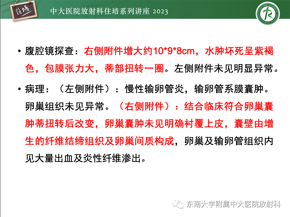 影像PPT - 【PPT】卵巢扭转诊断与鉴别诊断-40