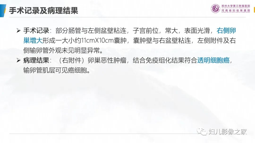 影像PPT - 【PPT】卵巢透明细胞癌-6