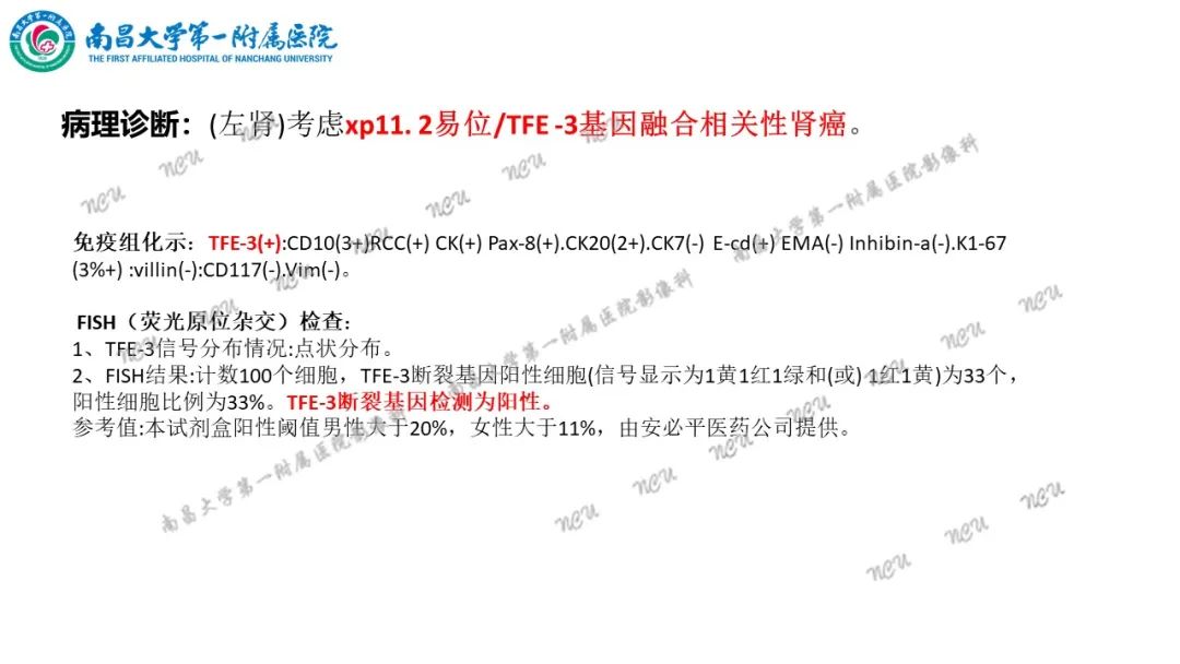 影像PPT - 【病例】MiT家族易位性肾细胞癌-10