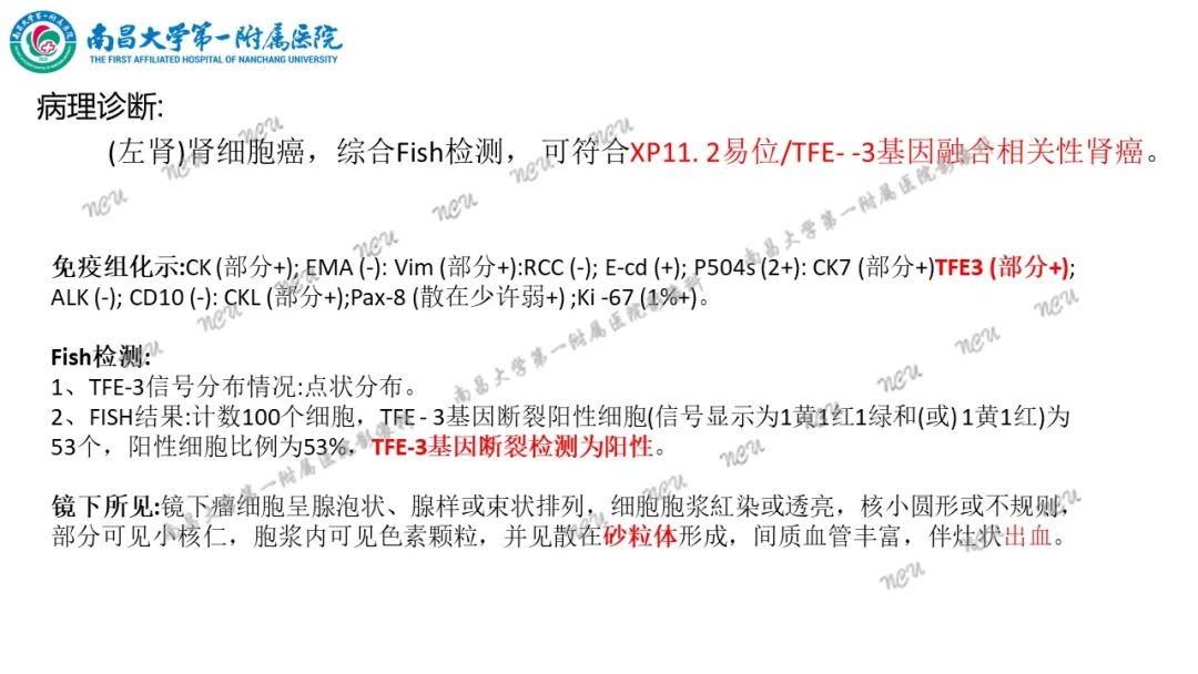 影像PPT - 【病例】MiT家族易位性肾细胞癌-17