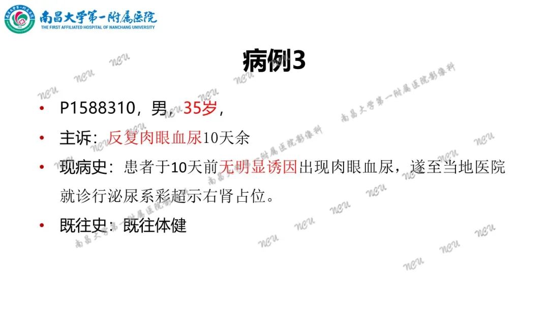 影像PPT - 【病例】MiT家族易位性肾细胞癌-18