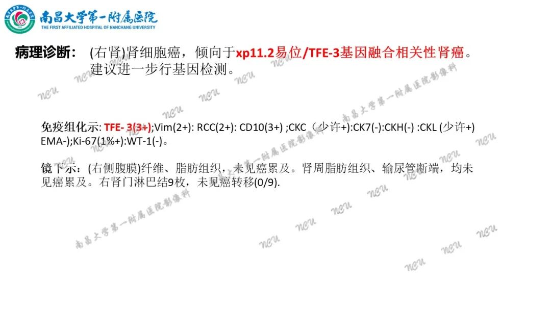 影像PPT - 【病例】MiT家族易位性肾细胞癌-26