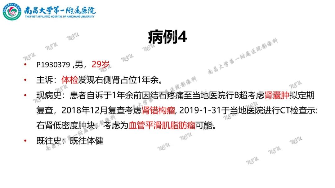 影像PPT - 【病例】MiT家族易位性肾细胞癌-27
