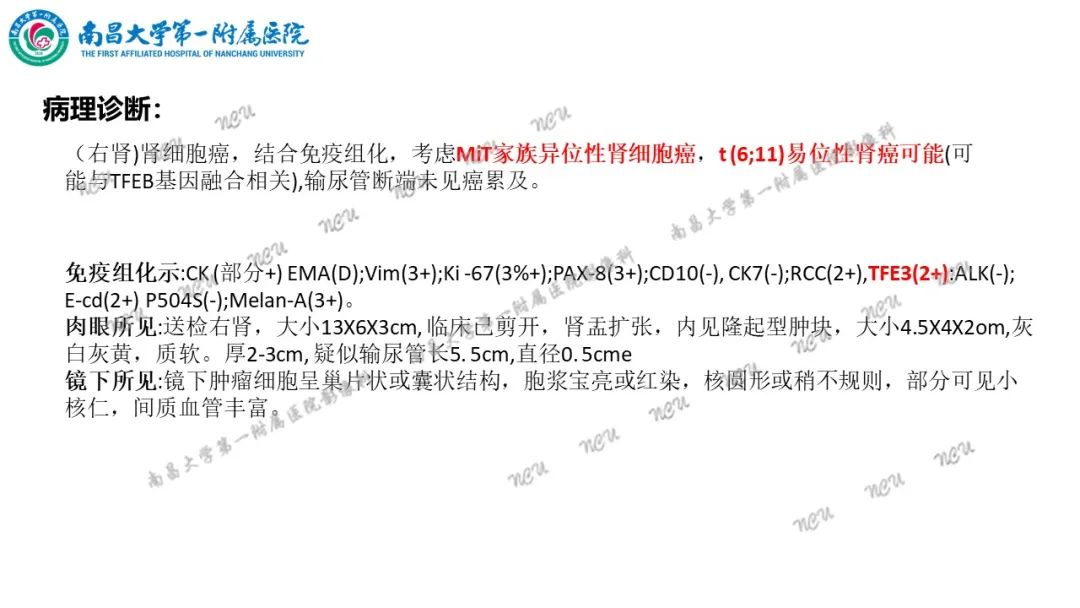 影像PPT - 【病例】MiT家族易位性肾细胞癌-34