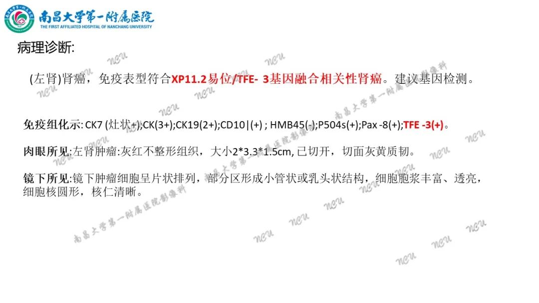 影像PPT - 【病例】MiT家族易位性肾细胞癌-46