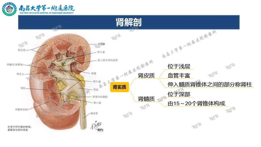 影像PPT - 【病例】MiT家族易位性肾细胞癌-47
