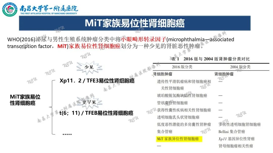 影像PPT - 【病例】MiT家族易位性肾细胞癌-49