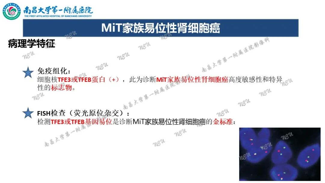影像PPT - 【病例】MiT家族易位性肾细胞癌-53