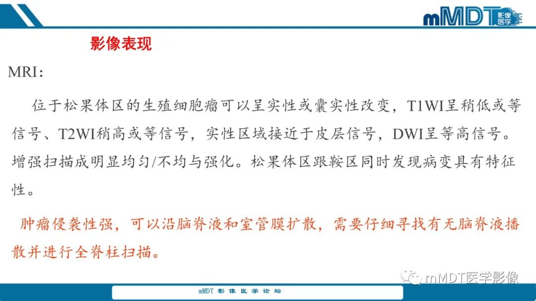 影像PPT - 【PPT】儿童颅内生殖细胞瘤的影像诊断与鉴别诊断-12