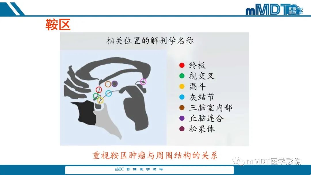 影像PPT - 【PPT】儿童颅内生殖细胞瘤的影像诊断与鉴别诊断-28