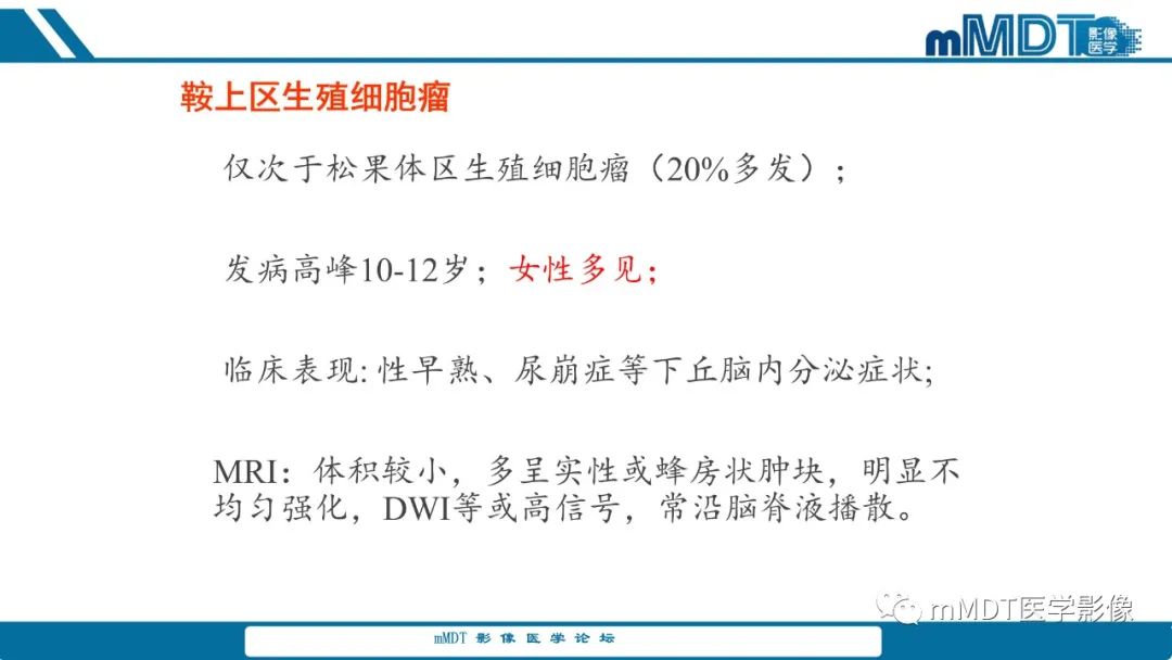 影像PPT - 【PPT】儿童颅内生殖细胞瘤的影像诊断与鉴别诊断-29