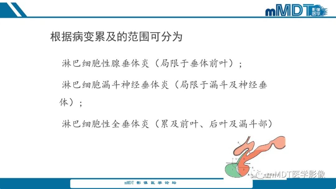 影像PPT - 【PPT】儿童颅内生殖细胞瘤的影像诊断与鉴别诊断-50