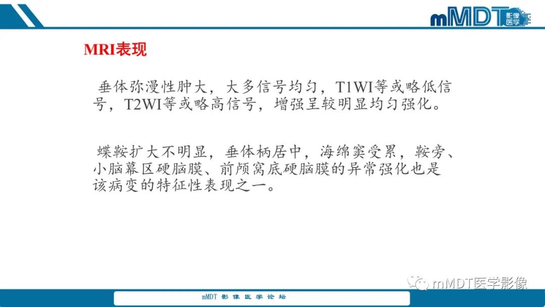影像PPT - 【PPT】儿童颅内生殖细胞瘤的影像诊断与鉴别诊断-51
