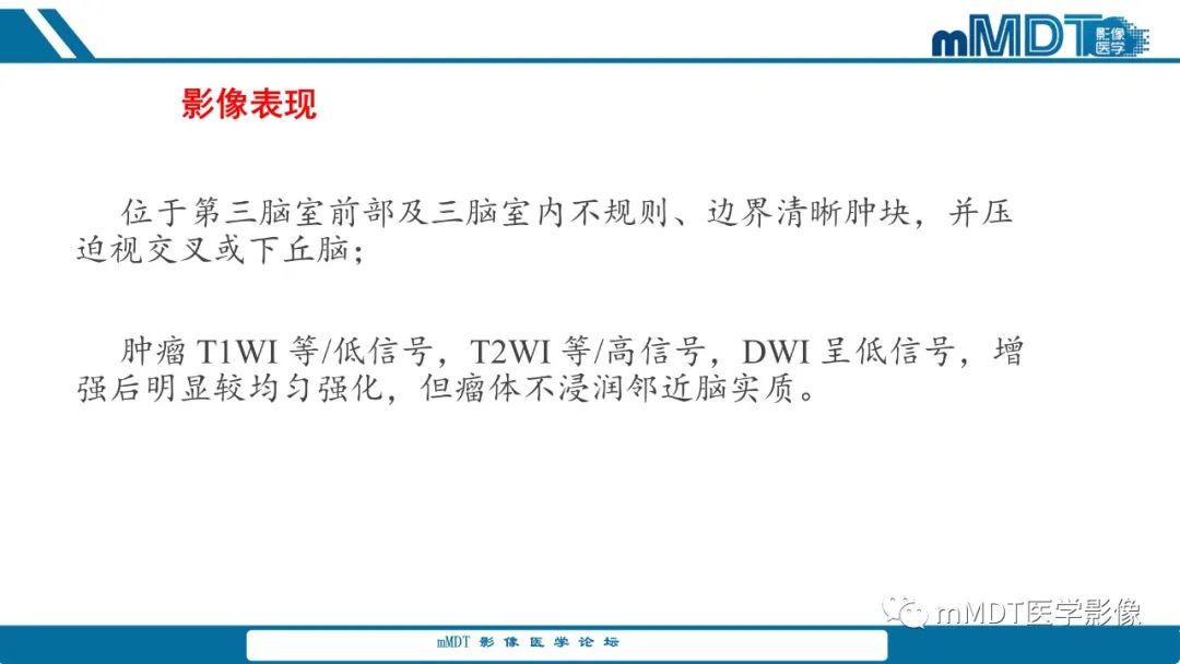 影像PPT - 【PPT】儿童颅内生殖细胞瘤的影像诊断与鉴别诊断-59