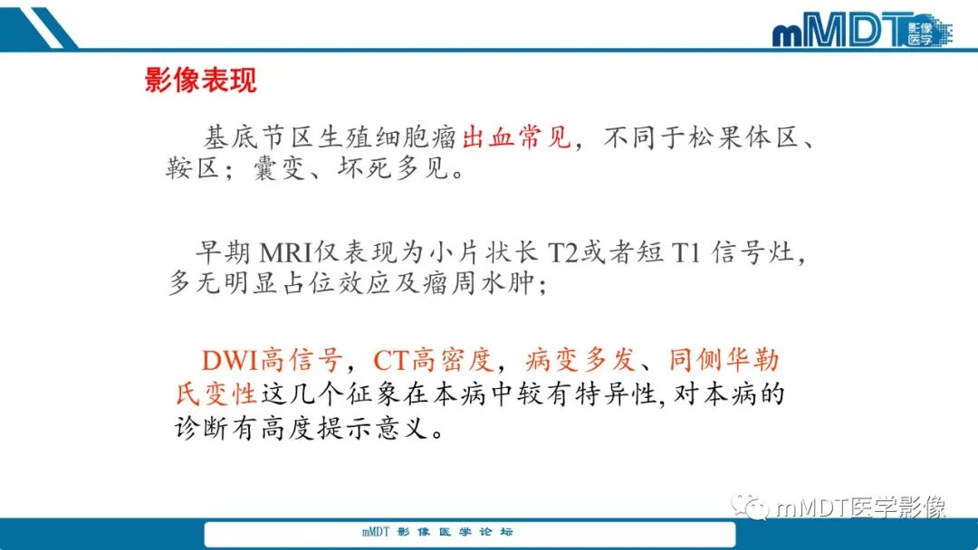 影像PPT - 【PPT】儿童颅内生殖细胞瘤的影像诊断与鉴别诊断-64