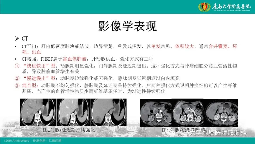 影像PPT - 【PPT】肝脏原发性神经内分泌肿瘤-14