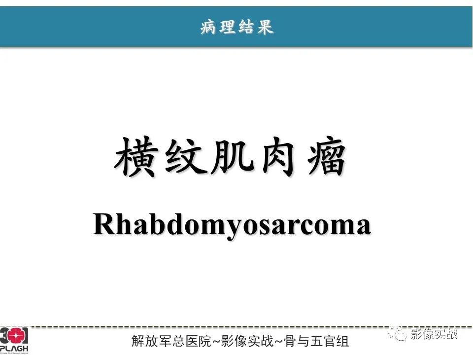 影像PPT - 【病例】大腿横纹肌肉瘤1例MR影像-10