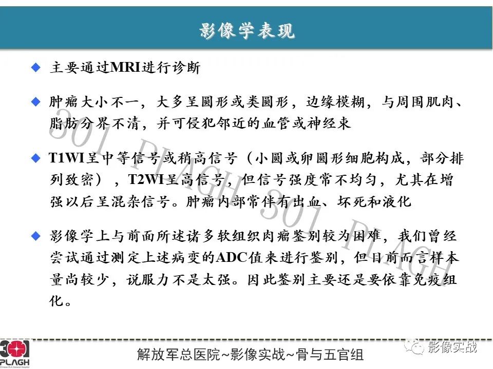 影像PPT - 【病例】大腿横纹肌肉瘤1例MR影像-16