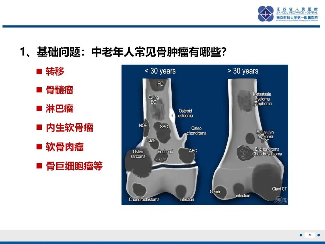 影像PPT - 【PPT】软骨肉瘤-16