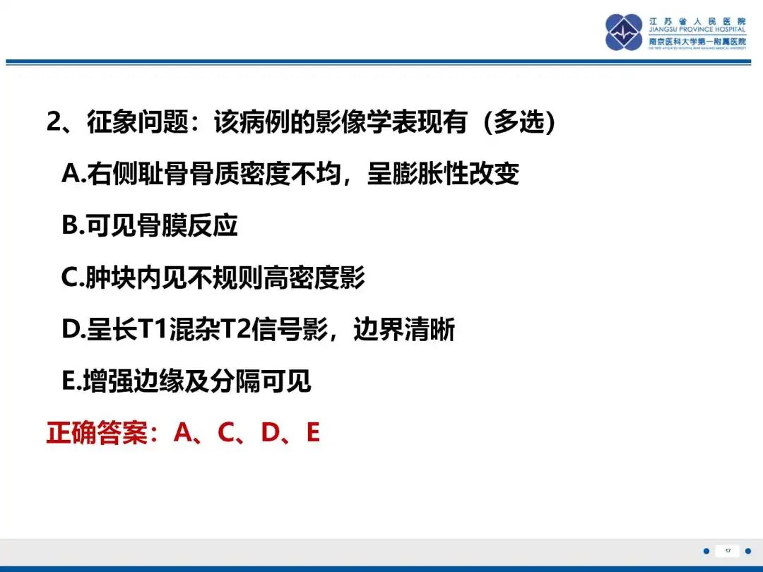 影像PPT - 【PPT】软骨肉瘤-18