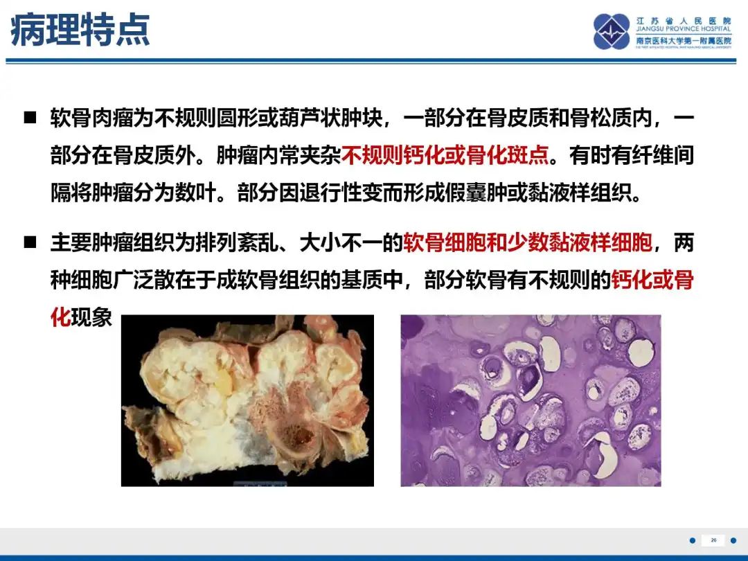 影像PPT - 【PPT】软骨肉瘤-27