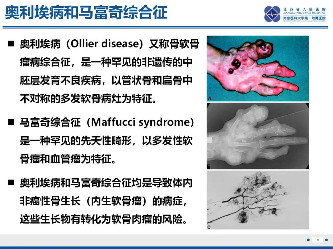 影像PPT - 【PPT】软骨肉瘤-41