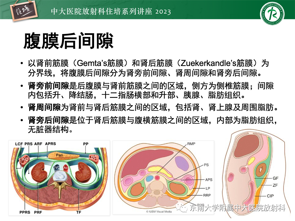 影像PPT - 【PPT】腹部脂肪坏死的影像诊断及主要鉴别-10