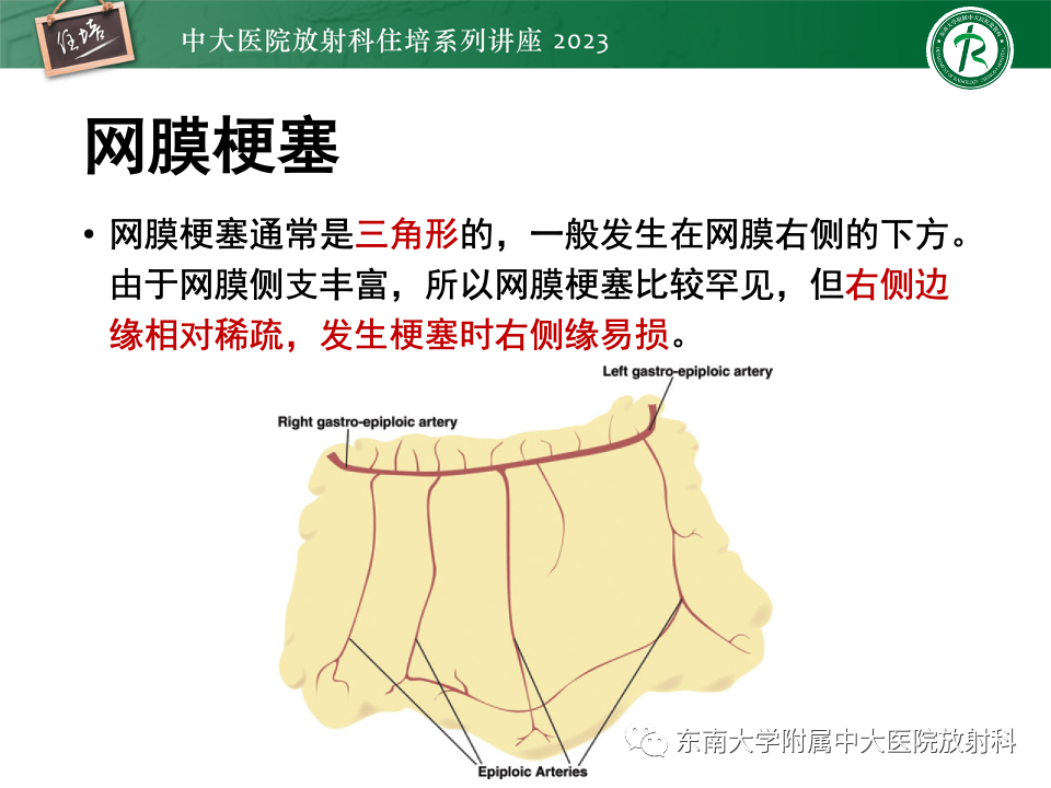 影像PPT - 【PPT】腹部脂肪坏死的影像诊断及主要鉴别-18