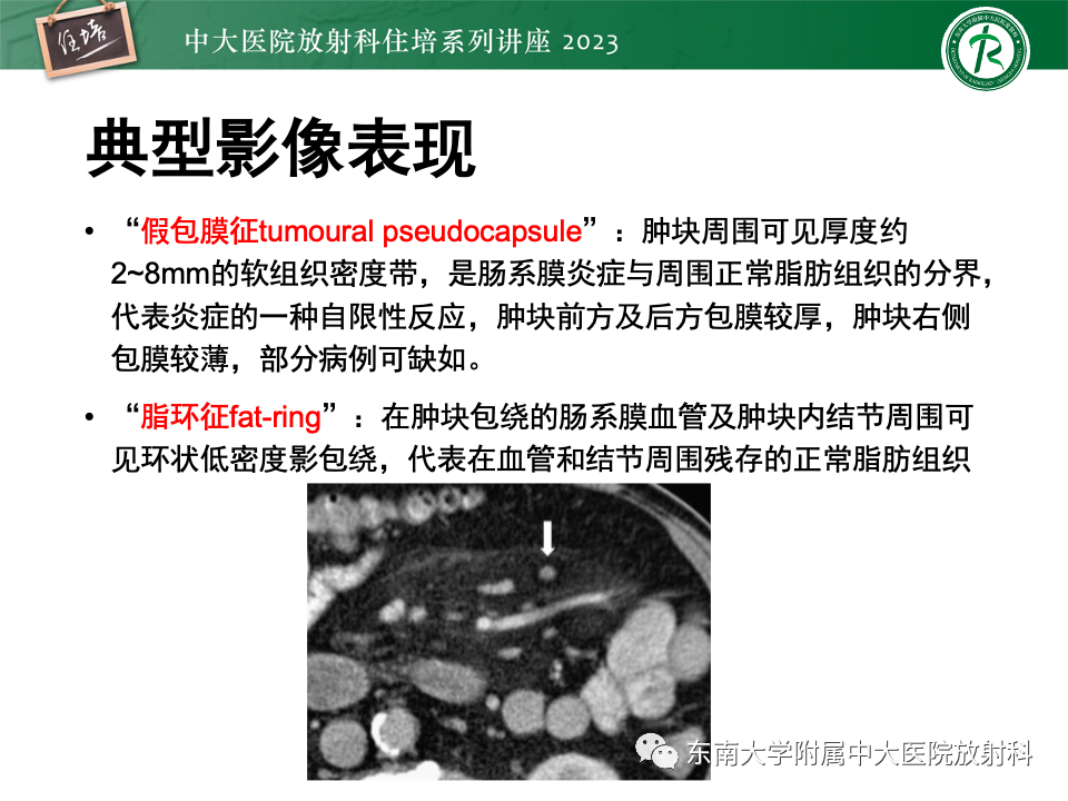 影像PPT - 【PPT】腹部脂肪坏死的影像诊断及主要鉴别-27
