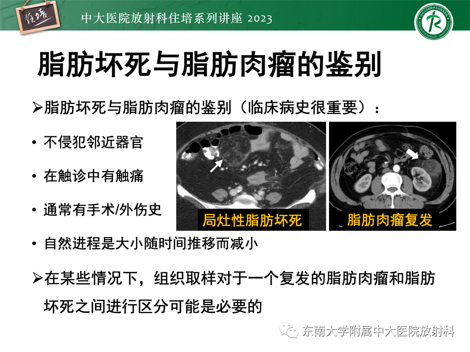 影像PPT - 【PPT】腹部脂肪坏死的影像诊断及主要鉴别-45