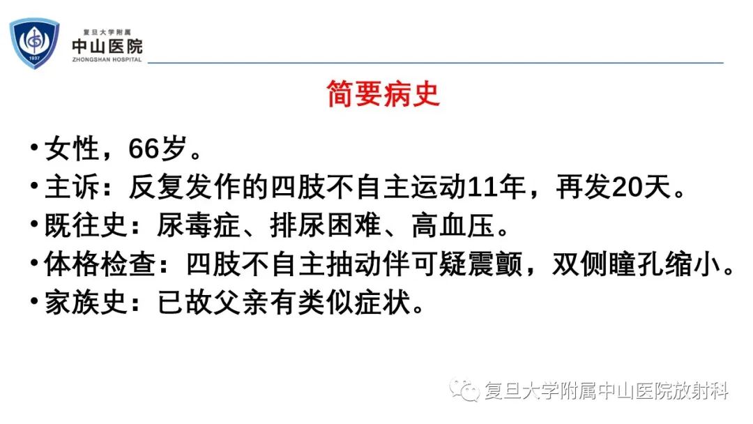 影像PPT - 【病例】神经元核内包涵体病1例CT及MR影像-2