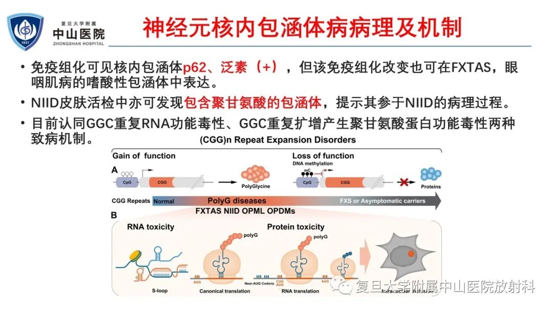 影像PPT - 【病例】神经元核内包涵体病1例CT及MR影像-9