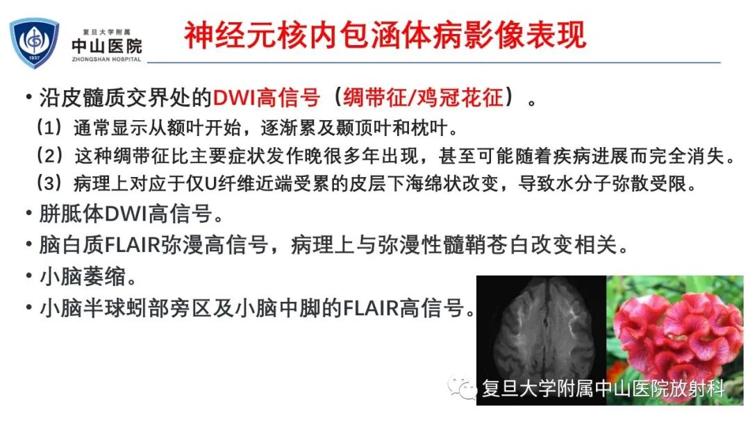 影像PPT - 【病例】神经元核内包涵体病1例CT及MR影像-14
