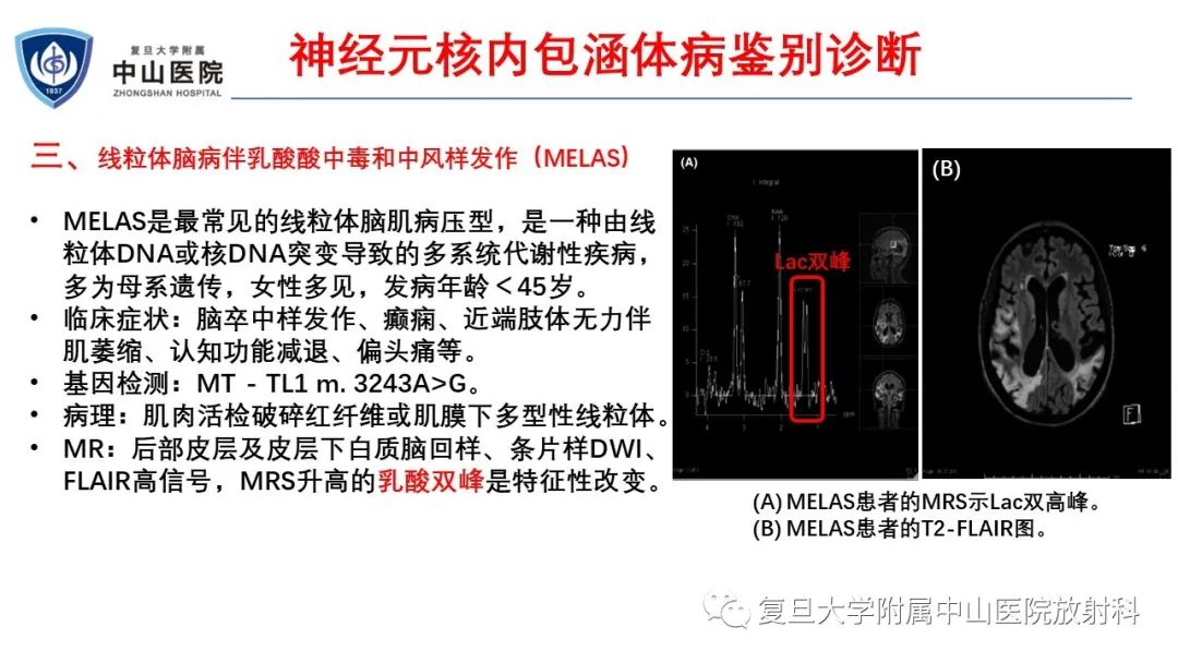 影像PPT - 【病例】神经元核内包涵体病1例CT及MR影像-23