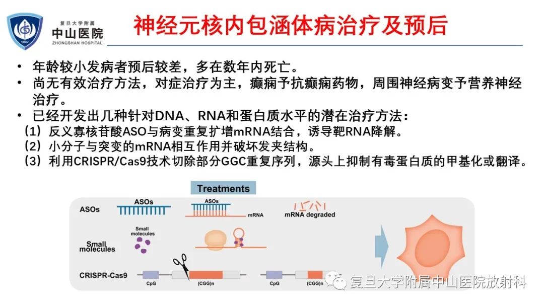 影像PPT - 【病例】神经元核内包涵体病1例CT及MR影像-27