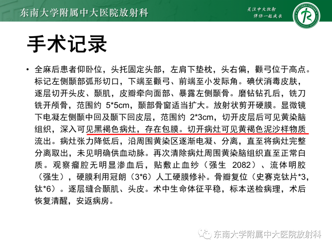 影像PPT - 【PPT】脑内血管肉瘤-35