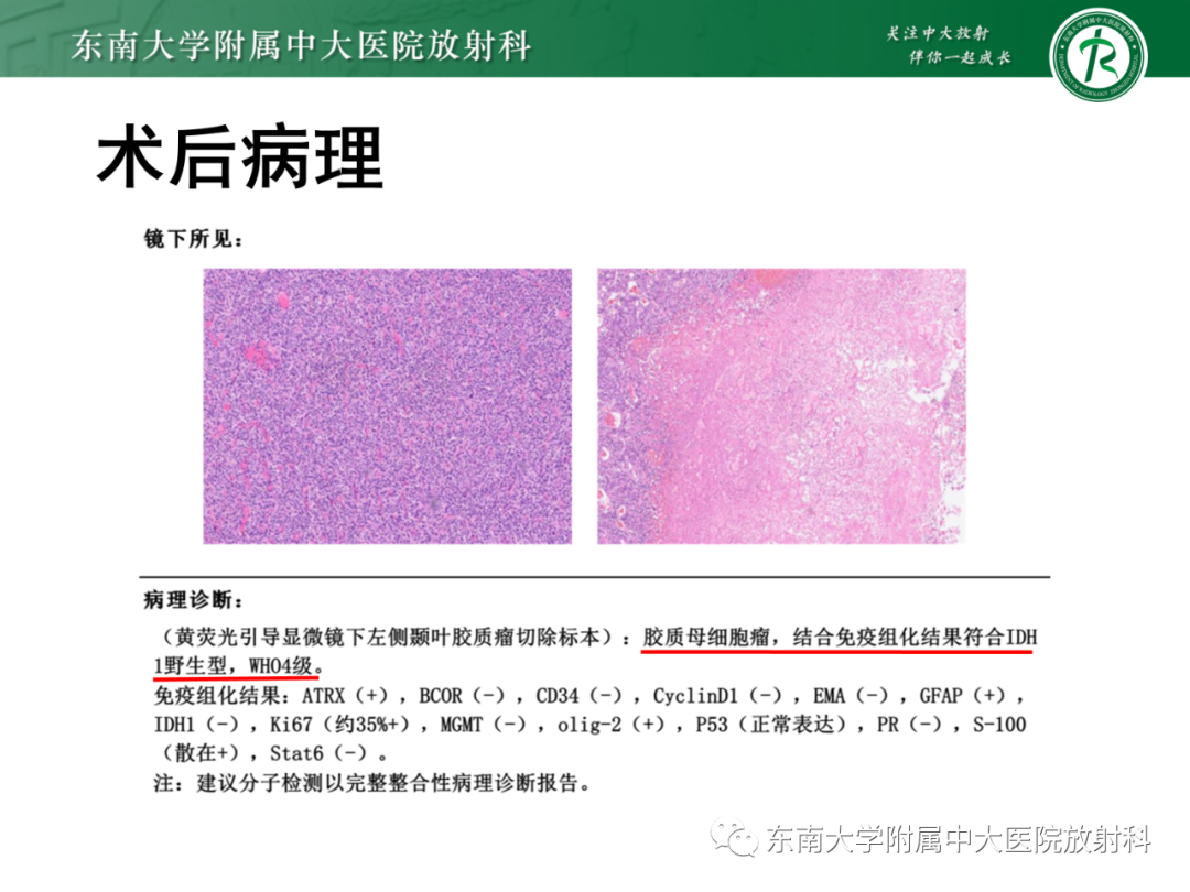 影像PPT - 【PPT】脑内血管肉瘤-42