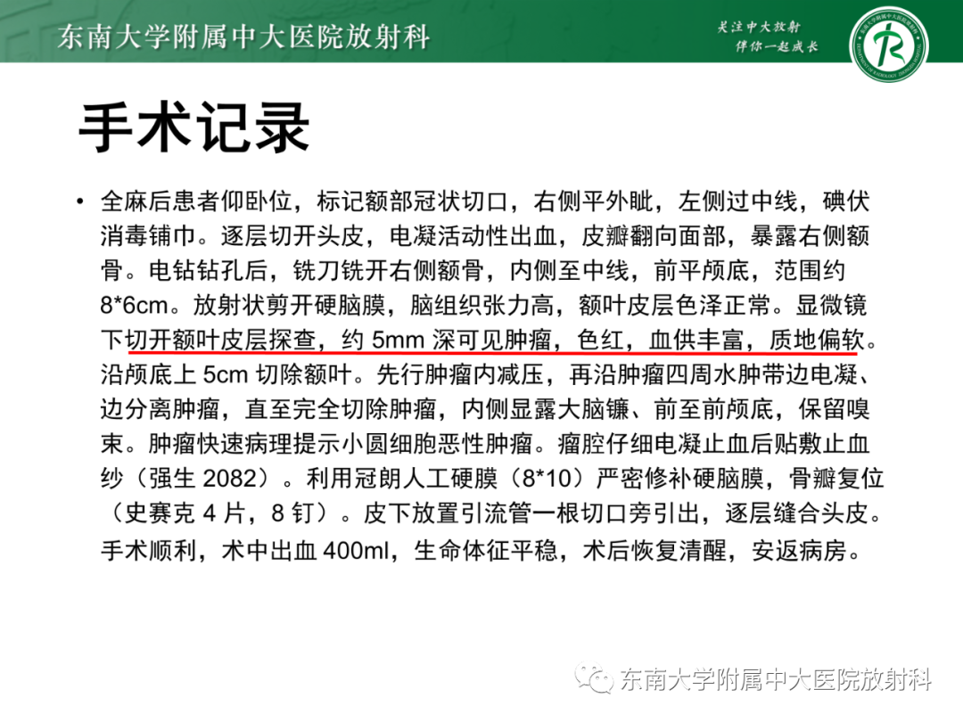 影像PPT - 【PPT】脑内血管肉瘤-47