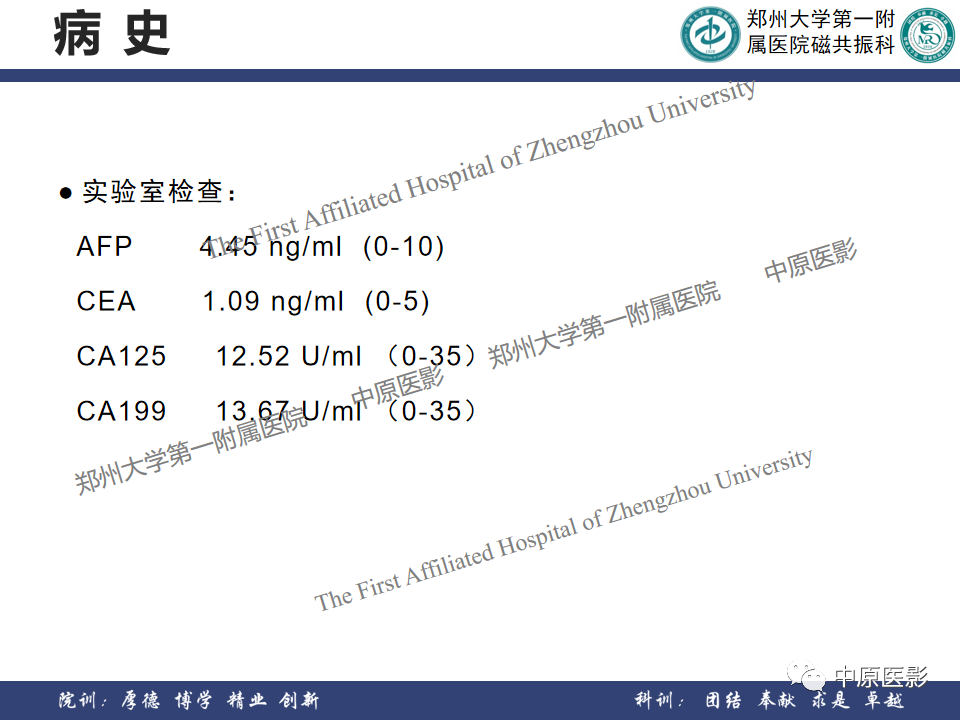 影像PPT - 【病例】肝脏上皮样血管内皮瘤1例MR影像-3