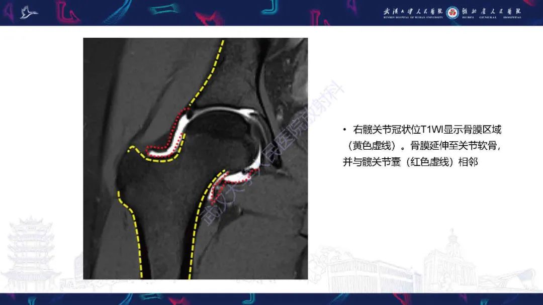 影像PPT - 【PPT】骨膜病变影像诊断-4