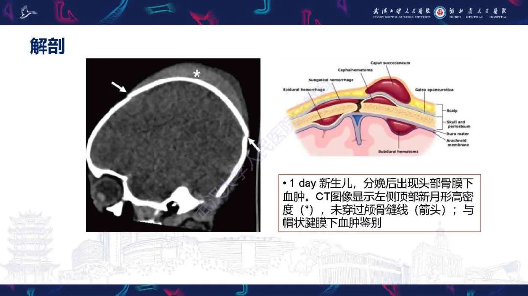 影像PPT - 【PPT】骨膜病变影像诊断-5