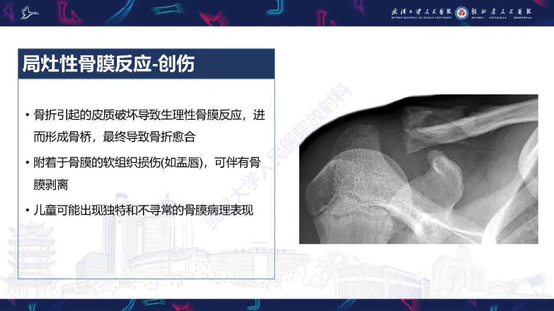 影像PPT - 【PPT】骨膜病变影像诊断-12