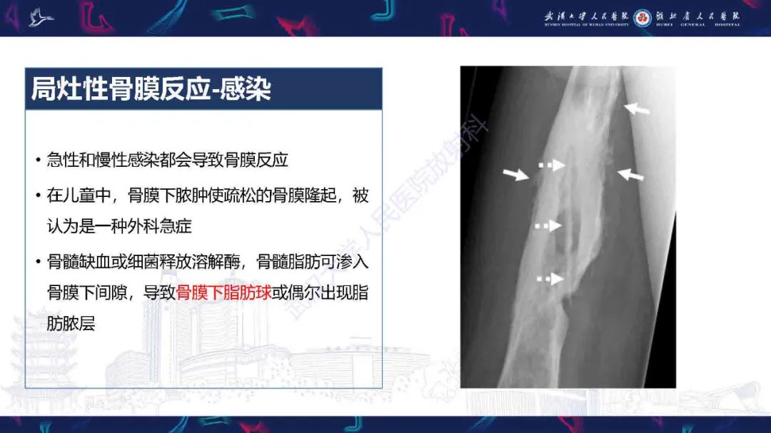 影像PPT - 【PPT】骨膜病变影像诊断-15