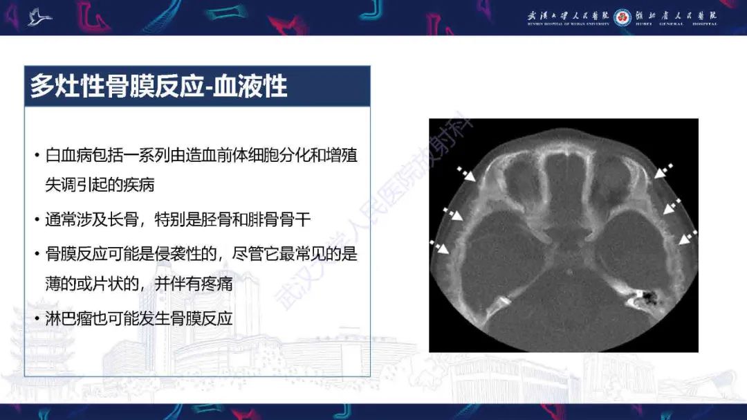 影像PPT - 【PPT】骨膜病变影像诊断-21