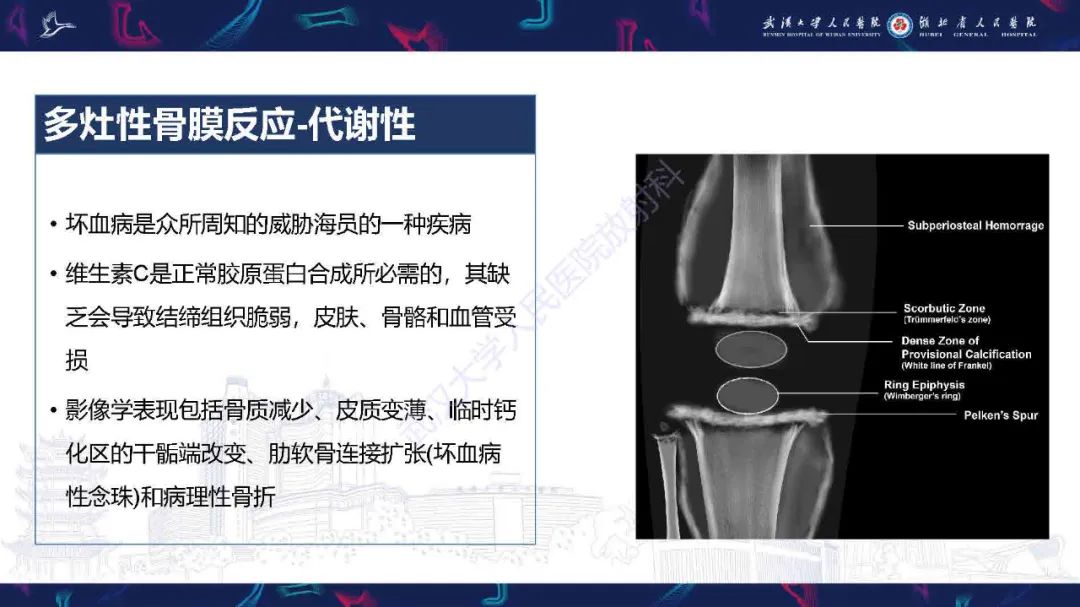 影像PPT - 【PPT】骨膜病变影像诊断-25