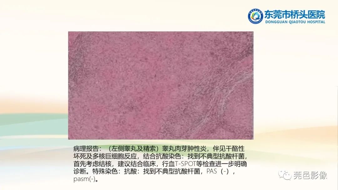 影像PPT - 【PPT】生殖系统结核一例分享-26