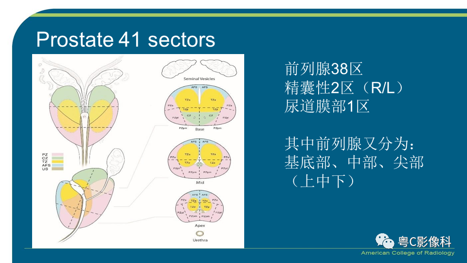 影像PPT - 【PPT】PI-RADS v2.1 修订解读并浅谈临床应用局限性-5 影像PPT - 【PPT】PI-RADS v2.1 修订解读并浅谈临床应用局限性-5